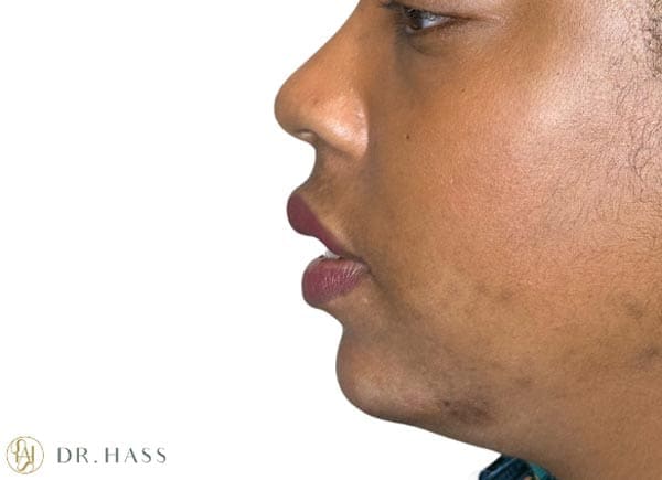 Dr Hass - Profile Balancing