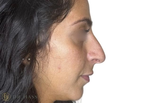 Dr Hass - Profile Balancing