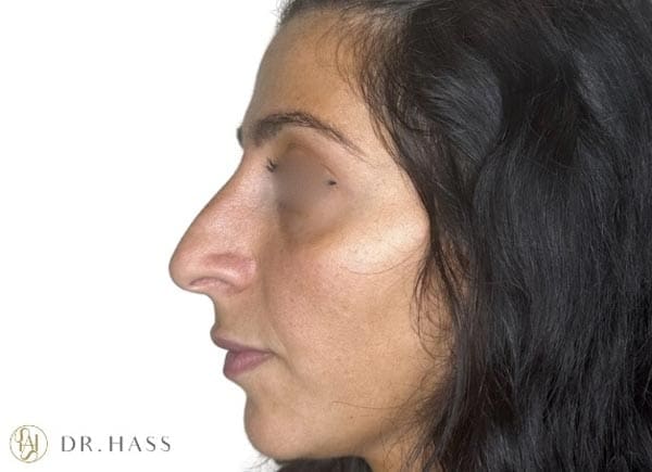 Dr Hass - Profile Balancing