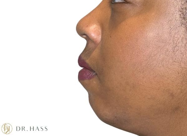 Dr Hass - Profile Balancing