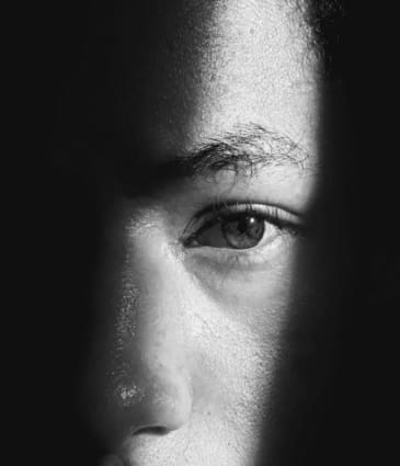 Under-eye rejuvenation