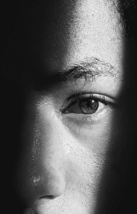 Under-eye rejuvenation