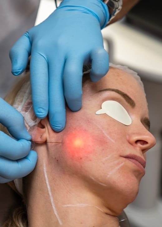 Dr Hass Clinic - Leading Endolift® Treatment London