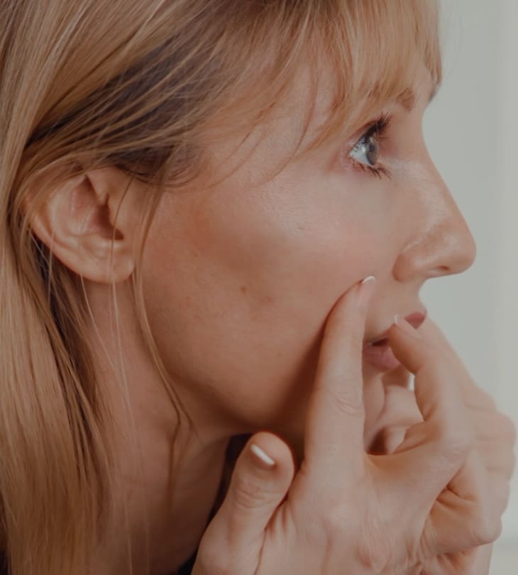 Female Patient After Endolift at Dr Hass Clinic in London