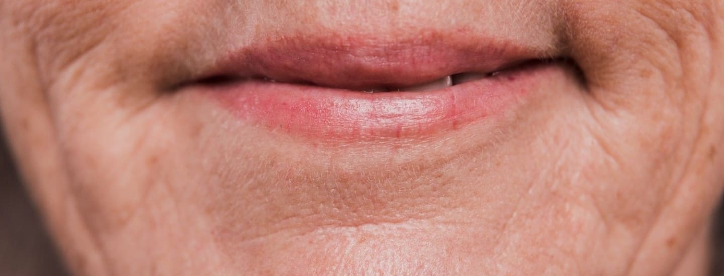 Marionette Filler - Dr Hass Clinic