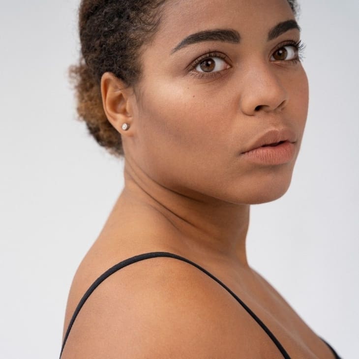 5 Real Signs You Are A Good Candidate for Cheek Filler