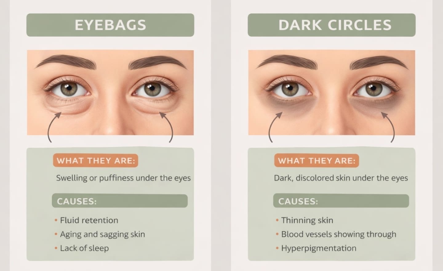 Infographic describing differences between Eye Bags and Dark Circles