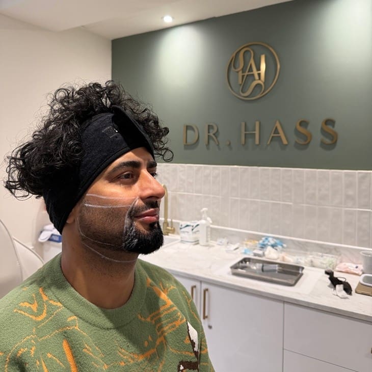 Male Endolift Patient at Dr Hass Clinic in London