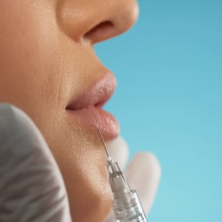 Is Lip Filler Safe