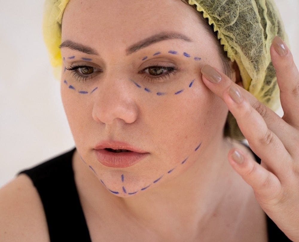 Cheek Filler vs Fat Transfer: Differences Explained