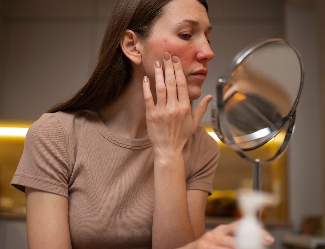 Microneedling Recovery and Aftercare - Dr Hass Clinic
