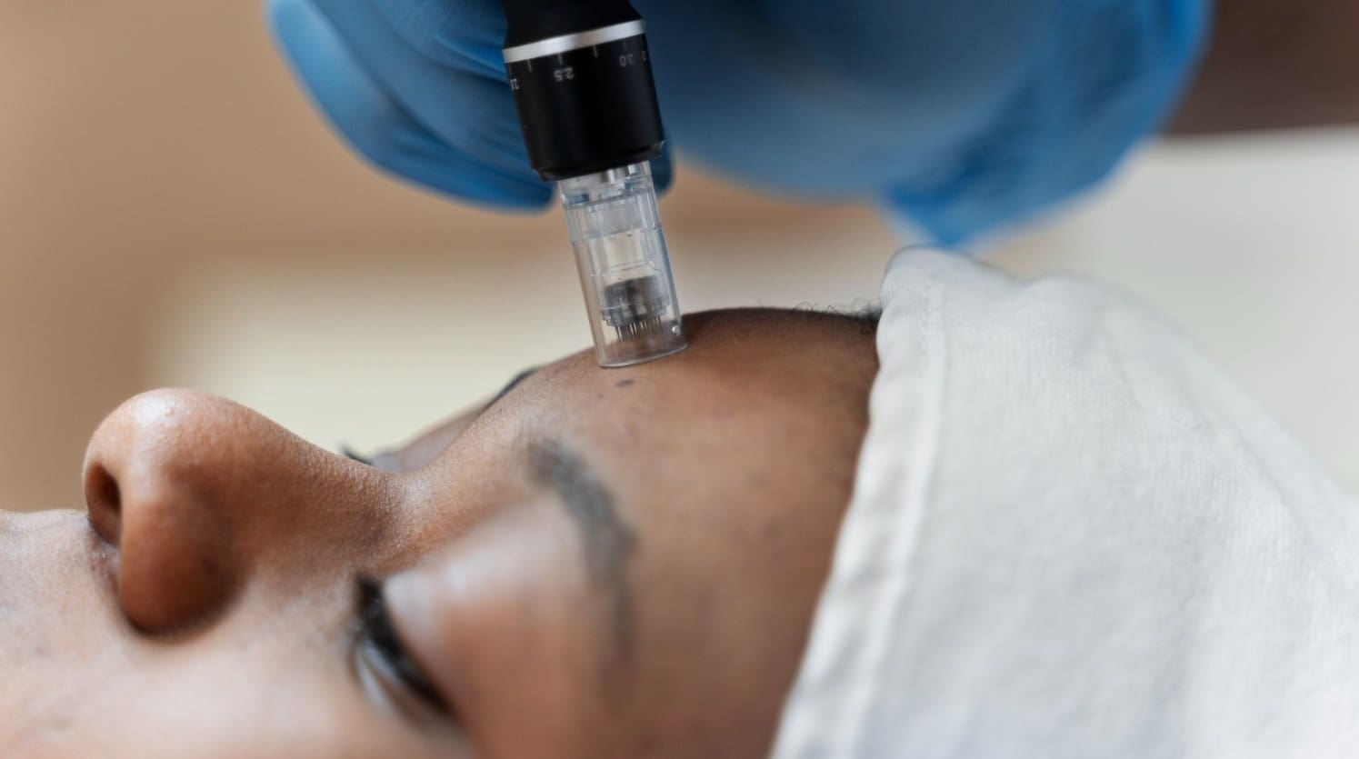 2. Treatment