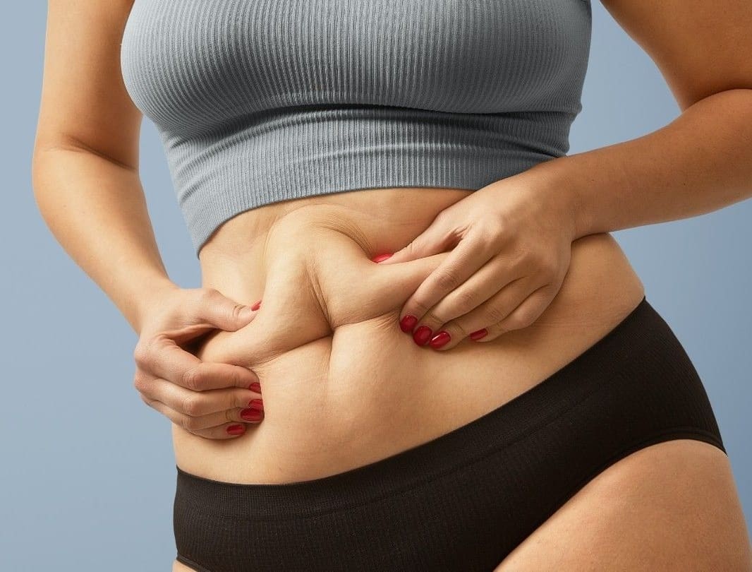 Fat Dissolving Injections vs Liposuction