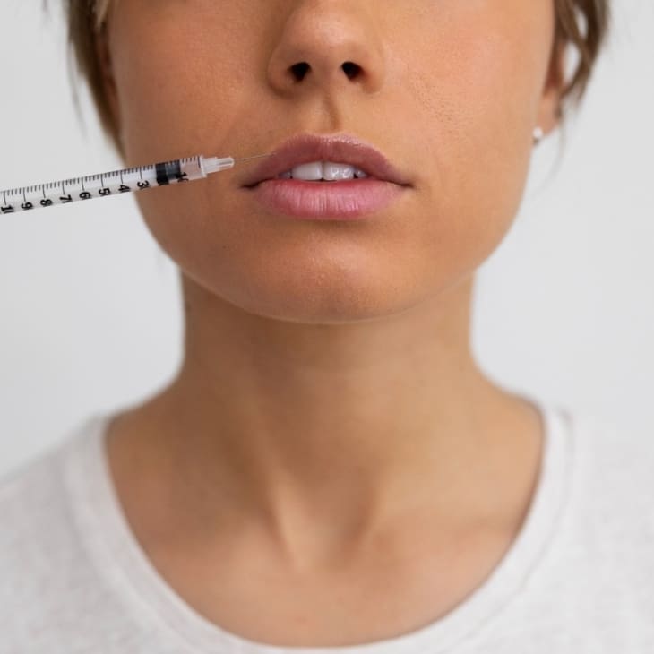 Is Nasolabial Fold Filler Safe? - Dr Hass Clinic