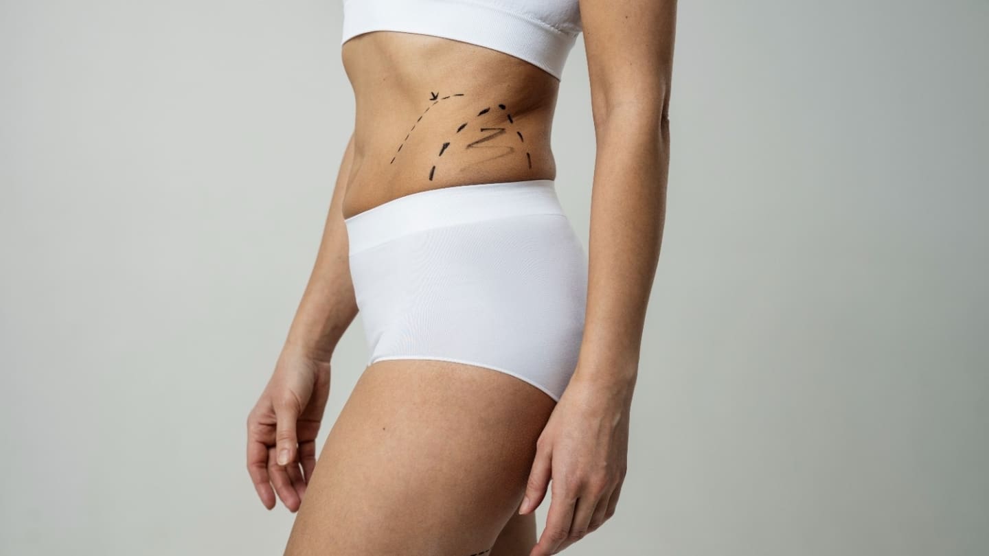 Side View Woman for Body Treatment - Dr Hass Clinic